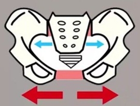 盆腔修復(fù)